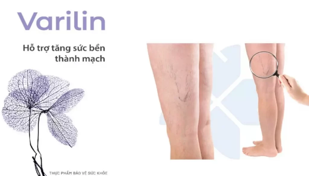 Varilin hỗ trợ suy giãn tĩnh mạch giá bao nhiêu