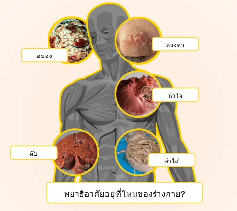 พยาธิอาศัยอยู่ที่ใดบ้าง?